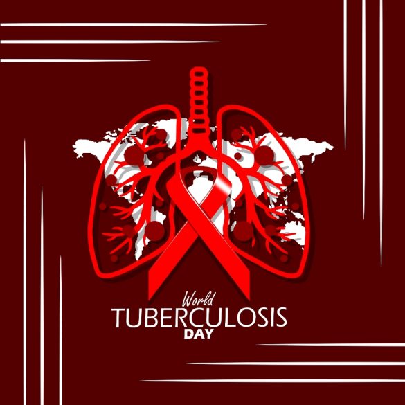 La Tuberculosis