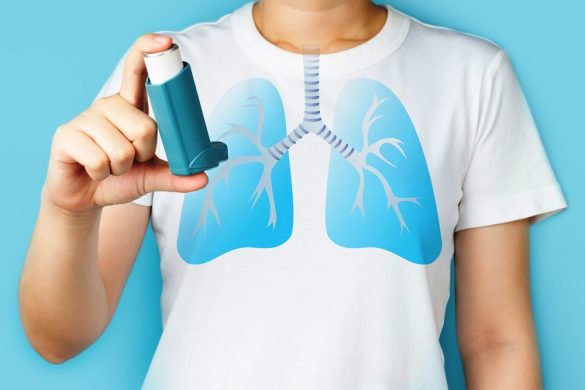 Neumonia y bronquitis
